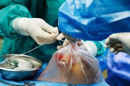 اهدای اعضای جوان دشتستانی جان سه بیمار نیازمند پیوند را نجات داد